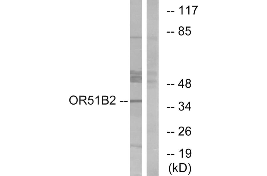 Western Blot - Anti-OR51B2 Antibody (G908) - Antibodies.com
