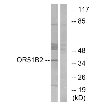 Western Blot - Anti-OR51B2 Antibody (G908) - Antibodies.com