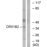 Western Blot - Anti-OR51B2 Antibody (G908) - Antibodies.com