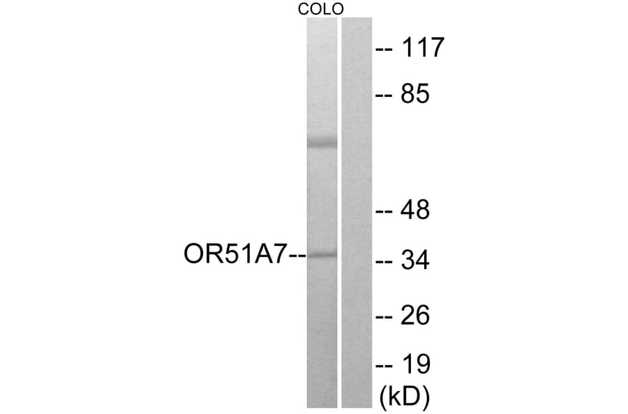 Western Blot - Anti-OR51A7 Antibody (G619) - Antibodies.com