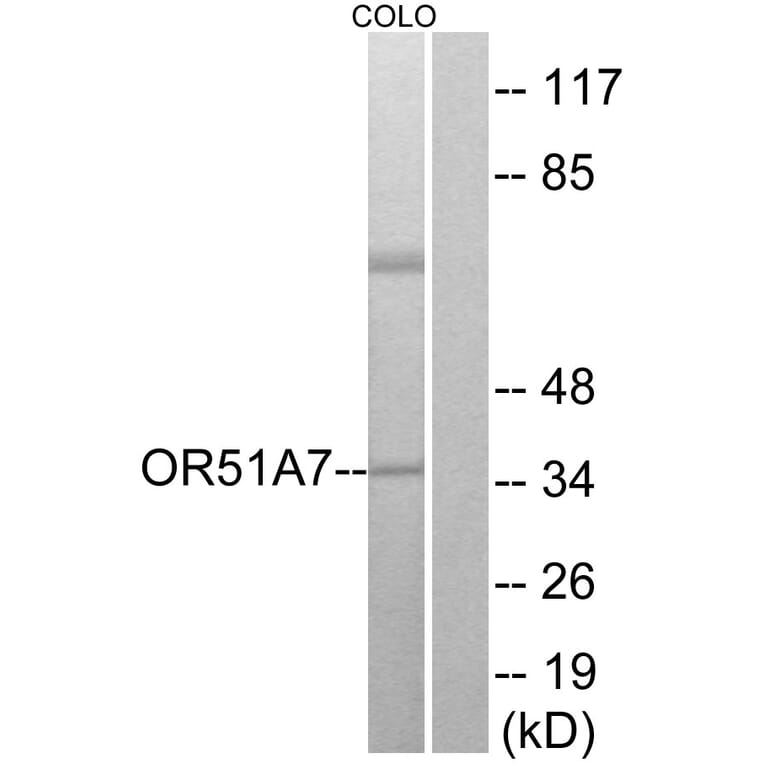 Western Blot - Anti-OR51A7 Antibody (G619) - Antibodies.com