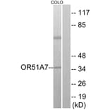 Western Blot - Anti-OR51A7 Antibody (G619) - Antibodies.com