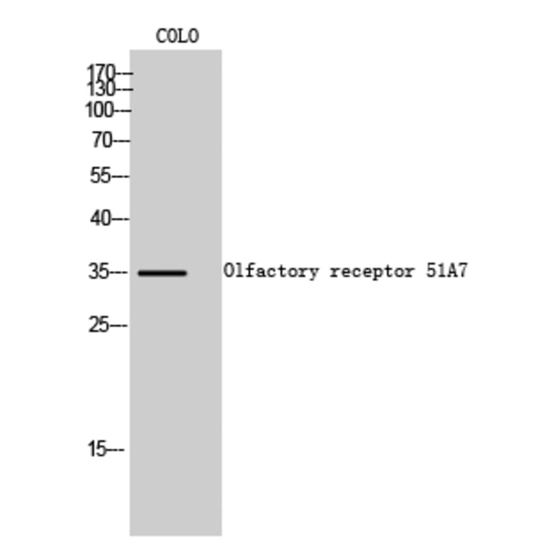 Western Blot - Anti-OR51A7 Antibody (G619) - Antibodies.com