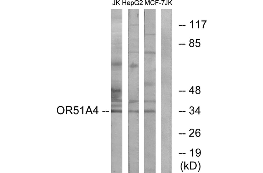 Western Blot - Anti-OR51A4 Antibody (G907) - Antibodies.com