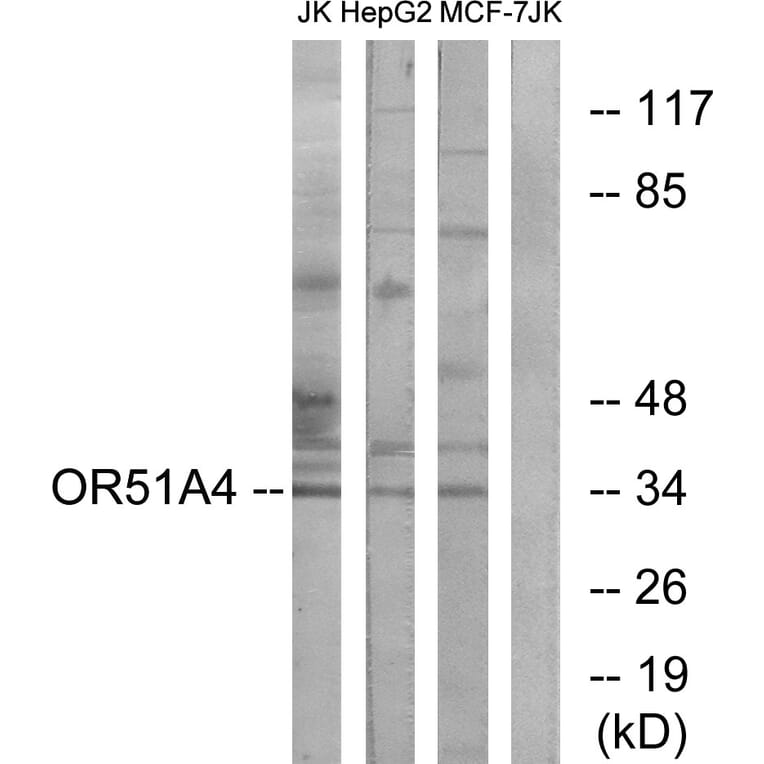 Western Blot - Anti-OR51A4 Antibody (G907) - Antibodies.com