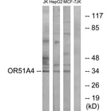 Western Blot - Anti-OR51A4 Antibody (G907) - Antibodies.com