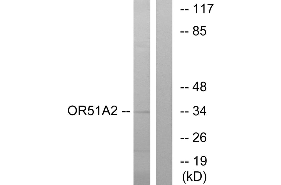 Western Blot - Anti-OR51A2 Antibody (G618) - Antibodies.com