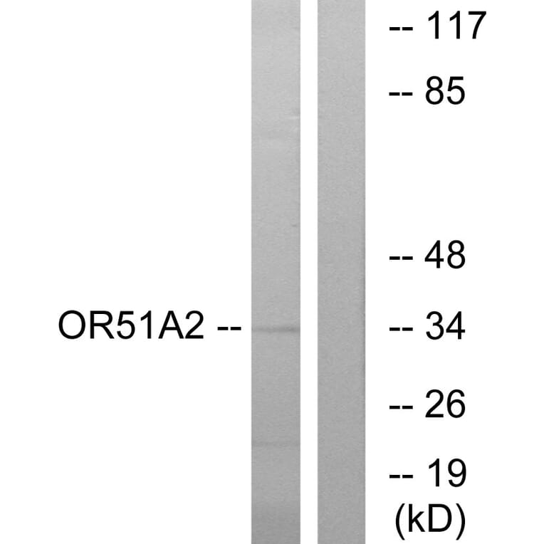 Western Blot - Anti-OR51A2 Antibody (G618) - Antibodies.com