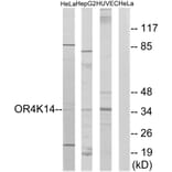 Western Blot - Anti-OR4K14 Antibody (G605) - Antibodies.com
