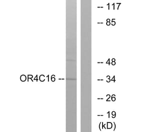 Western Blot - Anti-OR4C16 Antibody (G590) - Antibodies.com