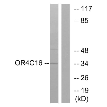 Western Blot - Anti-OR4C16 Antibody (G590) - Antibodies.com
