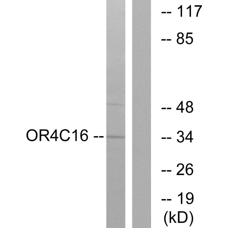 Western Blot - Anti-OR4C16 Antibody (G590) - Antibodies.com