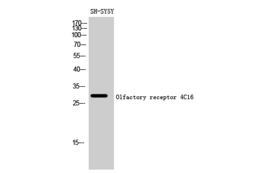 Western Blot - Anti-OR4C16 Antibody (G590) - Antibodies.com
