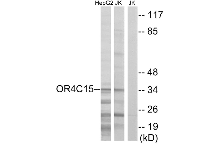 Western Blot - Anti-OR4C15 Antibody (G589) - Antibodies.com