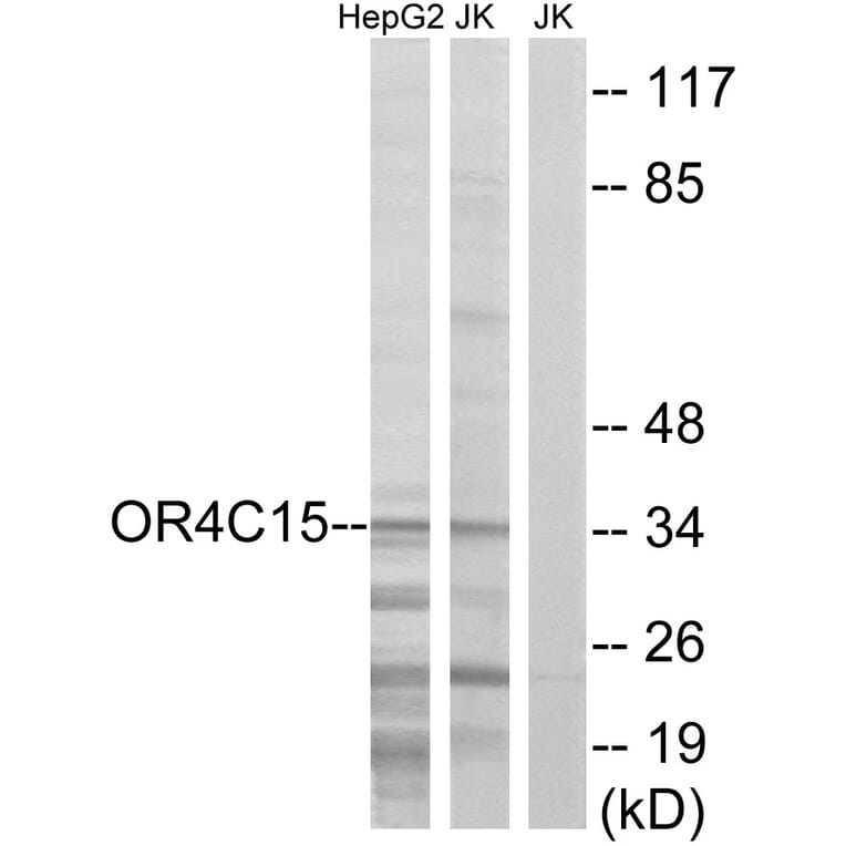 Western Blot - Anti-OR4C15 Antibody (G589) - Antibodies.com