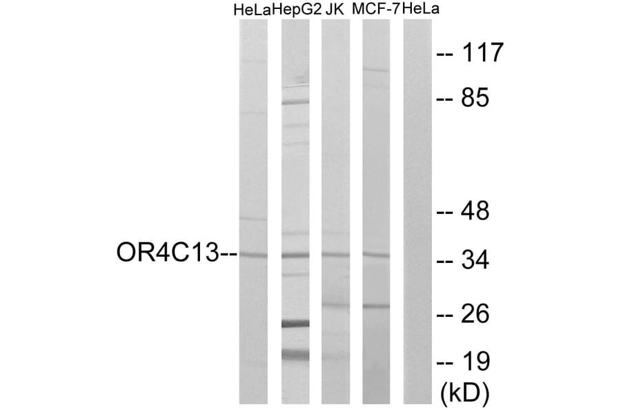Western Blot - Anti-OR4C13 Antibody (G588) - Antibodies.com