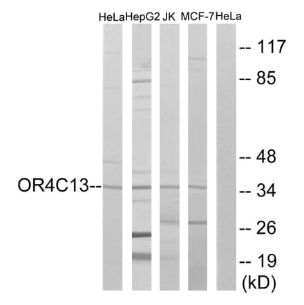 Western Blot - Anti-OR4C13 Antibody (G588) - Antibodies.com