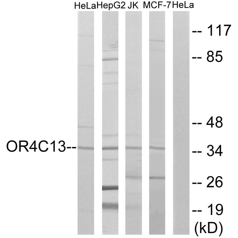 Western Blot - Anti-OR4C13 Antibody (G588) - Antibodies.com