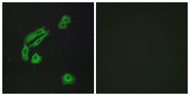 Immunofluorescence analysis of A549 cells using Anti-OR4C13 Antibody. The right hand panel represents a negative control, where the antibody was pre-incubated with the immunising peptide.