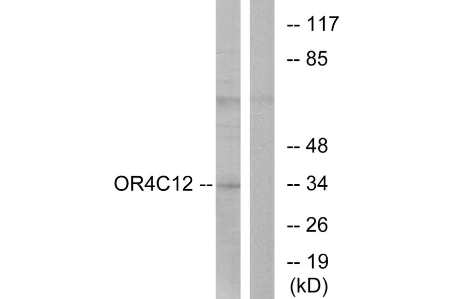 Western Blot - Anti-OR4C12 Antibody (G587) - Antibodies.com