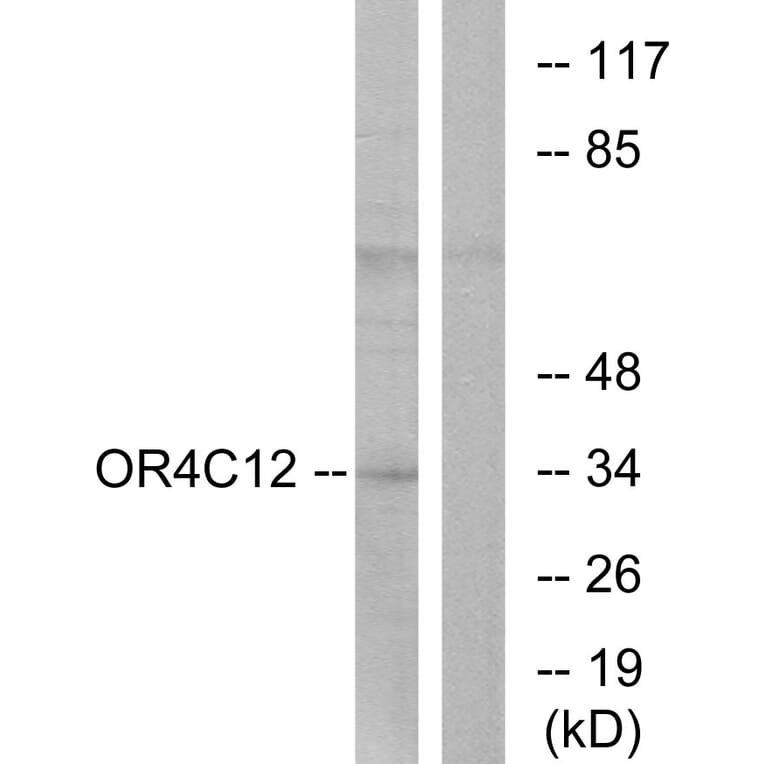 Western Blot - Anti-OR4C12 Antibody (G587) - Antibodies.com