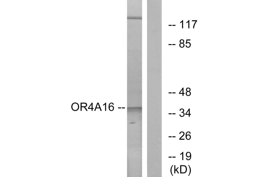 Western Blot - Anti-OR4A16 Antibody (G580) - Antibodies.com