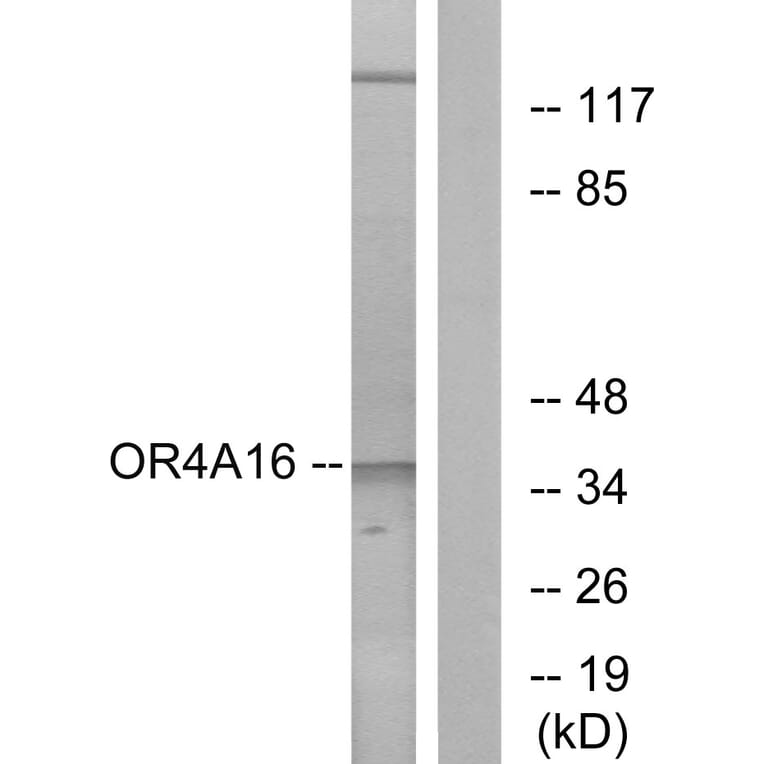 Western Blot - Anti-OR4A16 Antibody (G580) - Antibodies.com