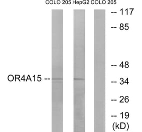 Western Blot - Anti-OR4A15 Antibody (G579) - Antibodies.com