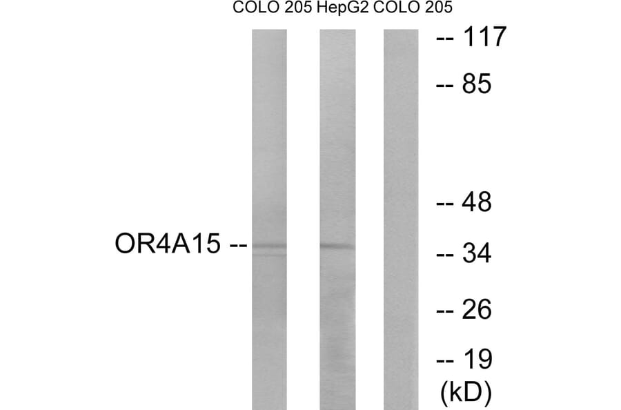 Western Blot - Anti-OR4A15 Antibody (G579) - Antibodies.com