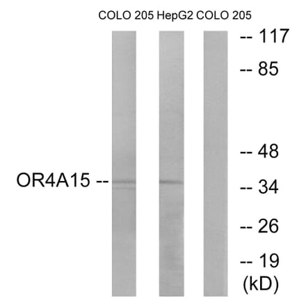 Western Blot - Anti-OR4A15 Antibody (G579) - Antibodies.com
