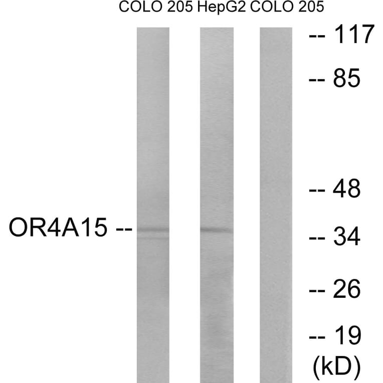 Western Blot - Anti-OR4A15 Antibody (G579) - Antibodies.com