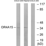Western Blot - Anti-OR4A15 Antibody (G579) - Antibodies.com