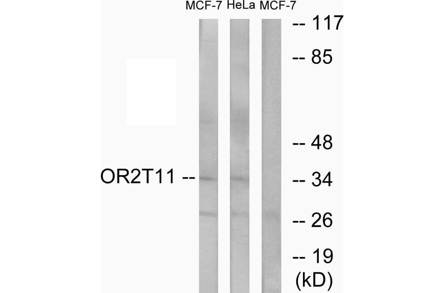 Western Blot - Anti-OR2T11 Antibody (G437) - Antibodies.com