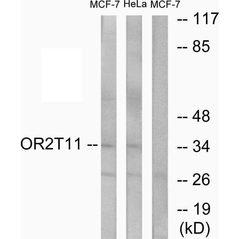 Western Blot - Anti-OR2T11 Antibody (G437) - Antibodies.com