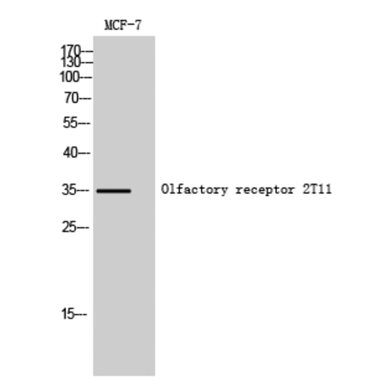 Western Blot - Anti-OR2T11 Antibody (G437) - Antibodies.com