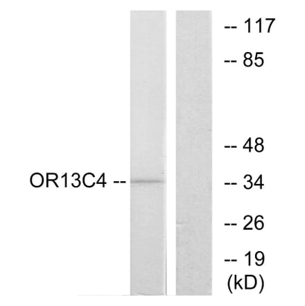 Western Blot - Anti-OR13C4 Antibody (G426) - Antibodies.com