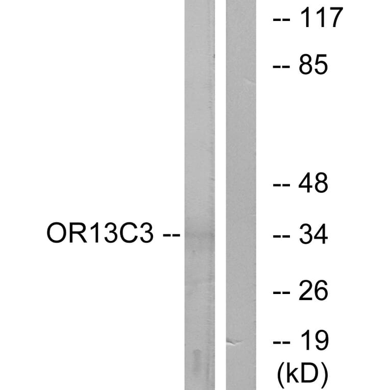 Western Blot - Anti-OR13C3 Antibody (G425) - Antibodies.com