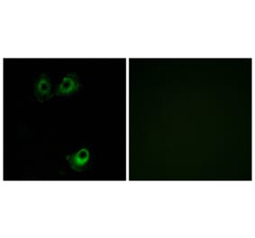 Immunofluorescence - Anti-OR11L1 Antibody (G424) - Antibodies.com