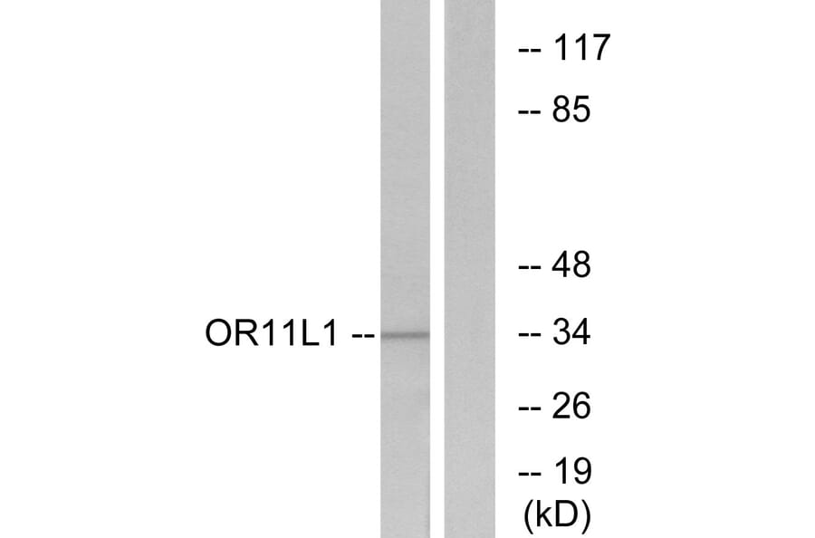 Western Blot - Anti-OR11L1 Antibody (G424) - Antibodies.com