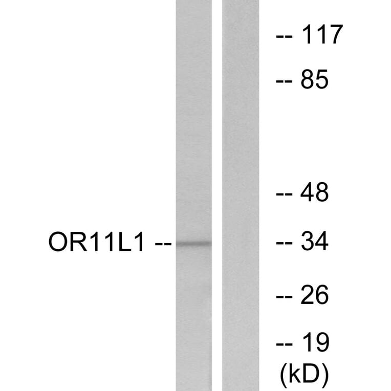 Western Blot - Anti-OR11L1 Antibody (G424) - Antibodies.com