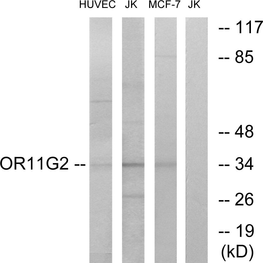 Western blot analysis of lysates from HUVEC, Jurkat, and MCF-7 cells using Anti-OR11G2 Antibody. The right hand lane represents a negative control, where the antibody is blocked by the immunising peptide.