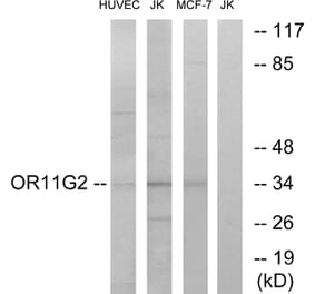 Western Blot - Anti-OR11G2 Antibody (G423) - Antibodies.com