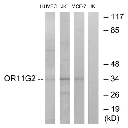 Western Blot - Anti-OR11G2 Antibody (G423) - Antibodies.com