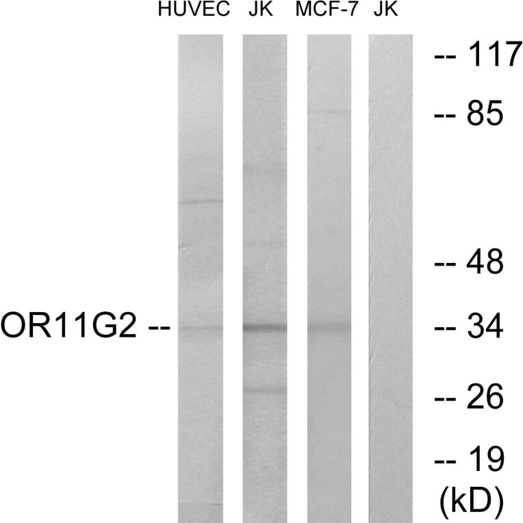 Western Blot - Anti-OR11G2 Antibody (G423) - Antibodies.com