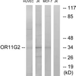 Western Blot - Anti-OR11G2 Antibody (G423) - Antibodies.com