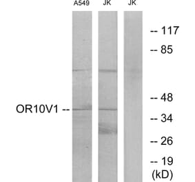 Western Blot - Anti-OR10V1 Antibody (G506) - Antibodies.com