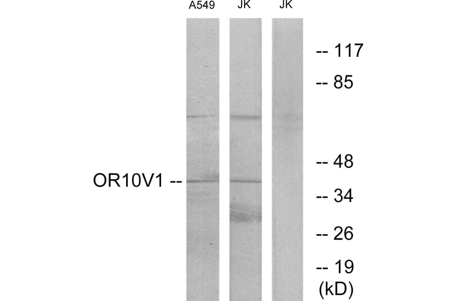 Western Blot - Anti-OR10V1 Antibody (G506) - Antibodies.com