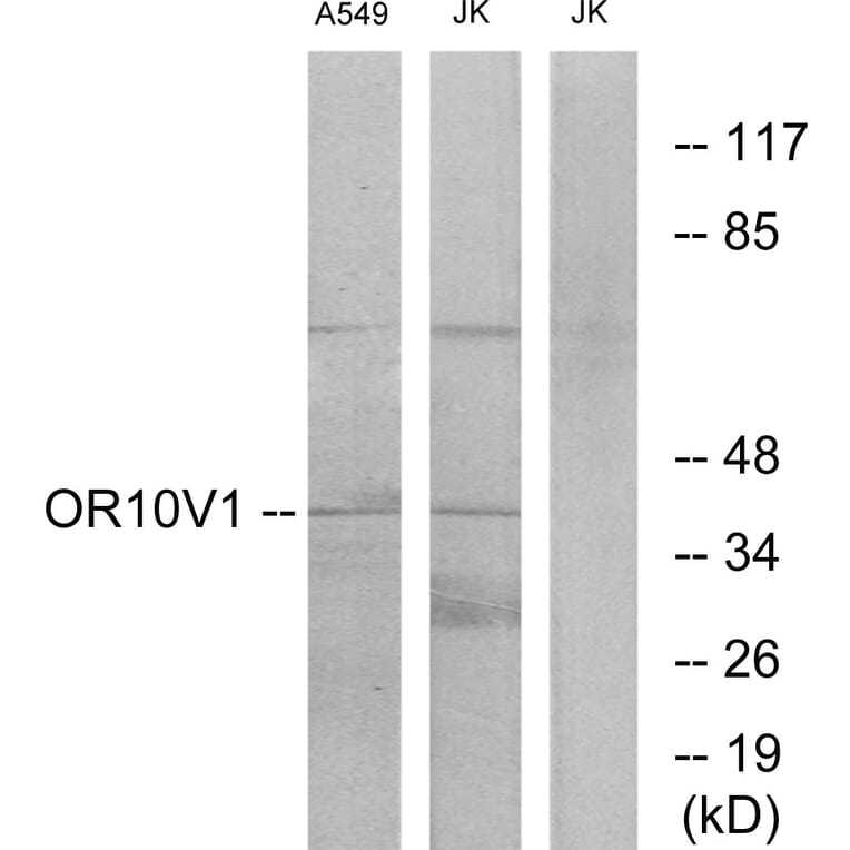 Western Blot - Anti-OR10V1 Antibody (G506) - Antibodies.com