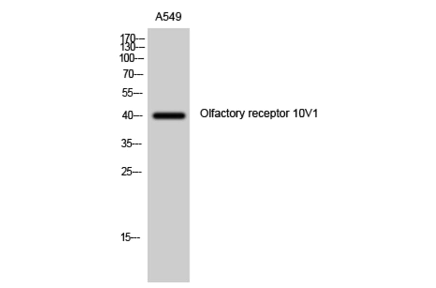 Western Blot - Anti-OR10V1 Antibody (G506) - Antibodies.com
