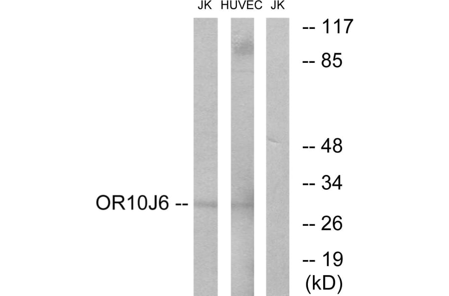 Western Blot - Anti-OR10J6 Antibody (G422) - Antibodies.com
